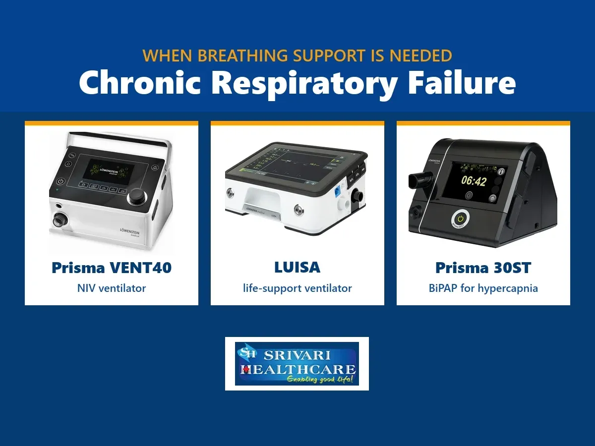 Chronic Respiratory Failure: Understanding When Breathing Support May Be Needed